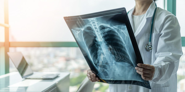 Turning AI onto itself: AI algorithm detects when medical images will be difficult for radiologists or AI to make an effective diagnosis
