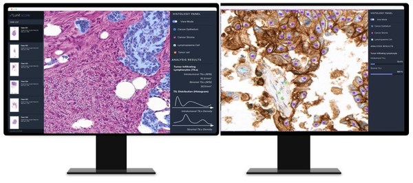 AI-based Analysis of Cancer Tissue Predicts Response to Immunotherapy–Findings to Be Presented at ASCO 2021