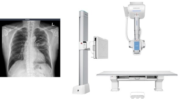VUNO Signs Another Deal with Samsung Electronics to Incorporate AI-assisted Solutions into Samsung’s Premium Ceiling Type Digital Radiography System